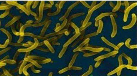 微生物菌劑好？好在哪里您知道嗎？